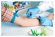 Early, precise prostate cancer detection
